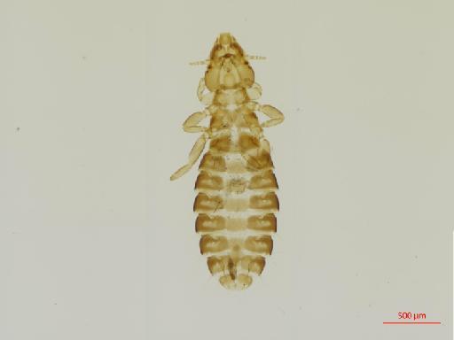 Pectinopygus punctatus Timmermann, 1964 - 010684082__2017_08_09-Scene-1-ScanRegion0