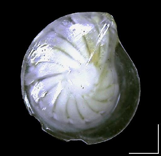 Cristellaria cultrata Montfort - ZF1320_Lenticulina iota1_umbilical.tif