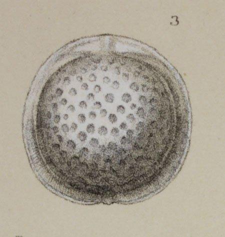 Lagena castrensis Schwager, 1866 - ZF1635_60_3_Fissurina_contusa.jpg