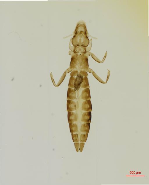 Anaticola cairinensis Monyeiro de Barros, 1933 - 010665954__2017_07_27-Scene-2-ScanRegion1