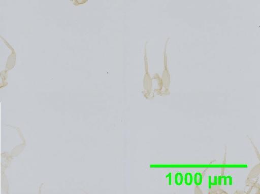 Liposcelis albothoracicus Broadhead, 1955 - 010150241__2016_03_15-4_s05