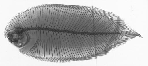 Brachirus heterolepis (Bleeker, 1856) - BMNH 1858.4.29.4, Synaptura heterolepis, radiograph