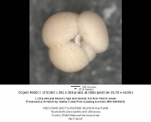 Globoquadrina conglomerata (Schwager) - ZF6465-Globoquadrina-conglomerata_obj00001_plane000.jpg