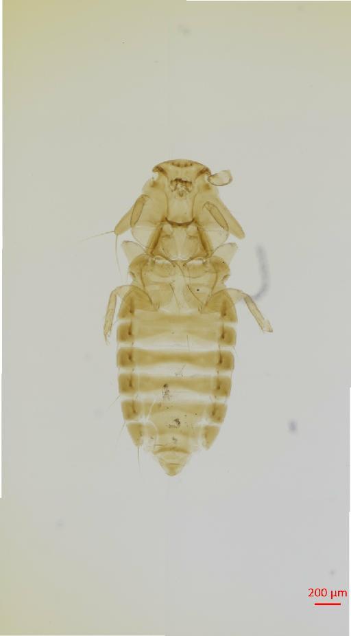 Megapeostus asymmetricus ruficipitis Clay, 1937 - 010682123__2017_08_08-Scene-2-ScanRegion1