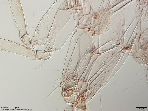 Lutzomyia (Nyssomyia) anduzei Rozeboom, 1942 - Lutzomyia_anduzei-BMNH(E)1722068_ST-female_lower_thorax-10x.tif