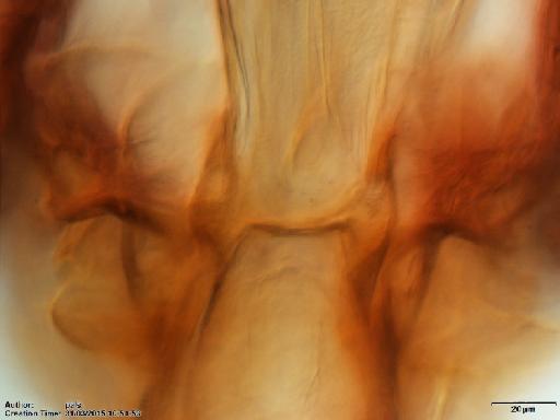 Warileya lumbrerasi Ogusuku et al., 1996 - Warileya_lumbrerasi-BMNH(E)1721980_PT-female_cibarium-40x.tif