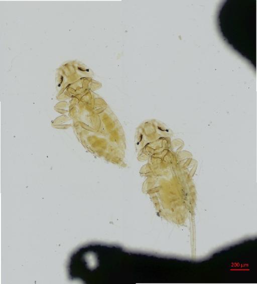 Menacanthus safedgal Ansari, 1951 - 010658143__2017_07_24-Scene-1-ScanRegion0