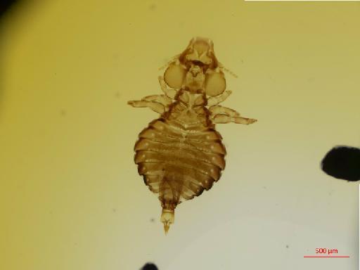 Saemundssonia scolopacis-phaeopodis Schrank, 1803 - 010692136__2017_08_11-Scene-1-ScanRegion0