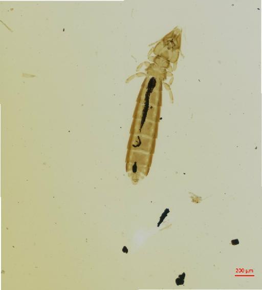 Brueelia domestica Kellogg & Chapman, 1899 - 010670579__2017_07_28-Scene-1-ScanRegion0