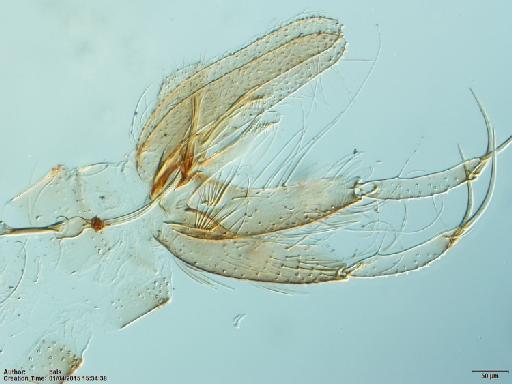 Lutzomyia (Coromyia) isovespertilionis Fairchild & Hertig, 1958 - Lutzomyia_isovespertilionis-BMNHH(E)1721986_PT-male_terminalia-10x.tif
