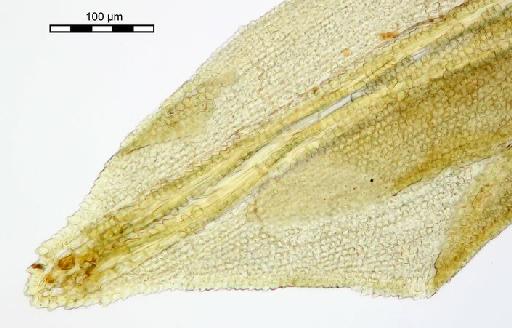 Calymperes erosum Müll.Hal. - Calymperes intralimbatum_BM000518376tip2.j