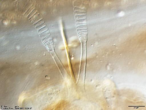 Lutzomyia (Nyssomyia) shawi Fraiha et al., 1981 - Lutzomyia_shawi_BMNH(E)1251317_PT-female_spermathecae_ducts-40x.tif