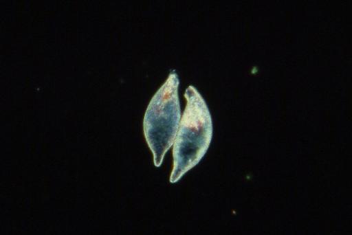 Cyphoderia trochus higher taxon Amoebae Penard - 1920-12-8-151A.jpg