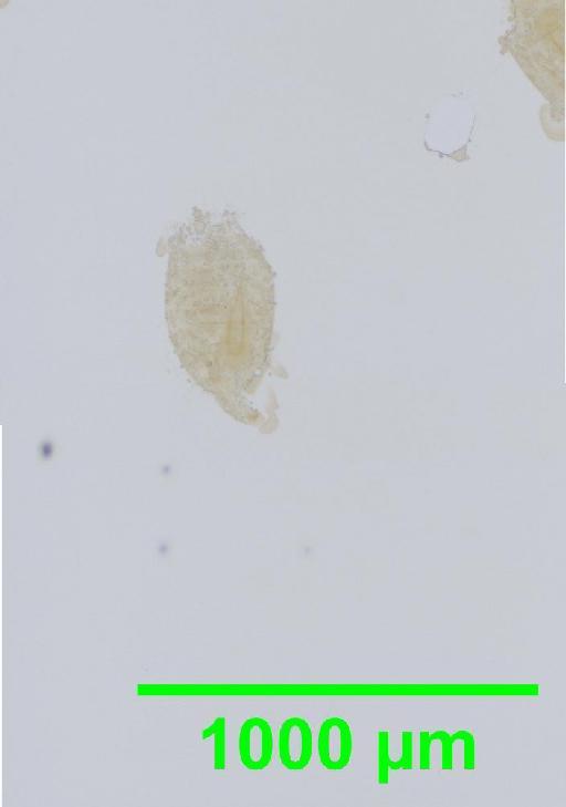 Liposcelis albothoracicus Broadhead, 1955 - 010150247__2016_03_15-4_s13