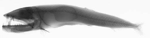 Omosudis lowei Günther, 1887 - BMNH 2019.8.7.15, Omosudis lowei, radiograph