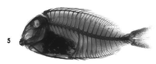 Acanthurus olivaceus Bloch & Schneider, 1801 ex Forster - BMNH 1962.12.14.5, HOLOTYPE, Acanthurus olivaceus, radiograph