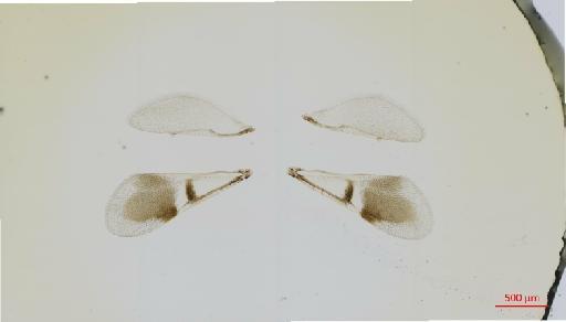 Hexacladia mensia Noyes, 2010 - 010178948__2017_01_31-1-Scene-1-ScanRegion0