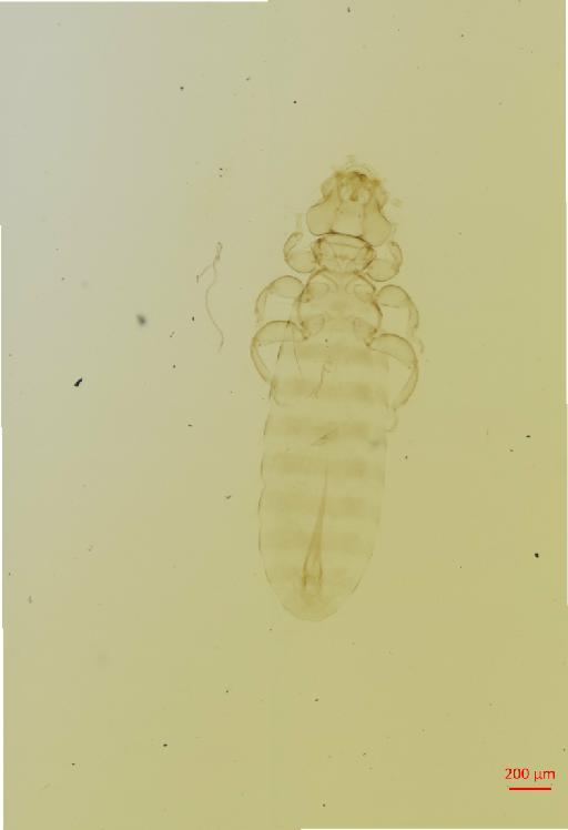 Actornithophilus sabulosus Clay, 1962 - 010650413__2017_07_18-Scene-2-ScanRegion1