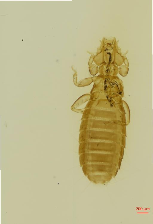 Dennyus (Collodennyus) singhi Clayton, Price & Page, 1996 - 010656247__2017_07_20-Scene-1-ScanRegion0