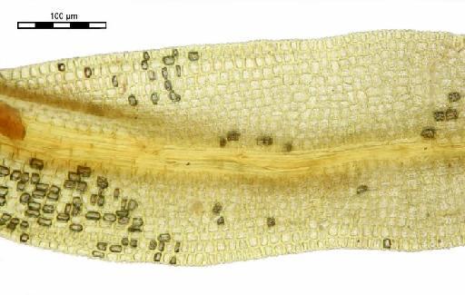 Leptodontium styriacum (Jur.) Limpr. - Didymodon styriacus_BM001006430margins.jp