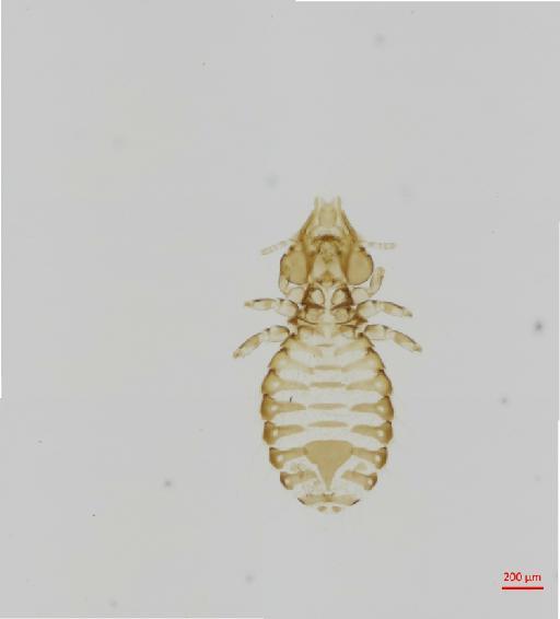 Sturnidoecus textoris Tendeiro, 1964 - 010694551__2017_08_11-Scene-1-ScanRegion0