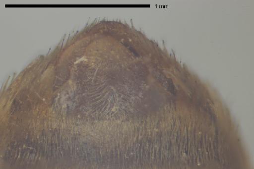 Ancylosceles ursinus Haliday in Curtis et al., 1836 - Ancylosceles_ursinus-NHMUK010265363-male-syntype-metasoma_apex_ventral-8_0x