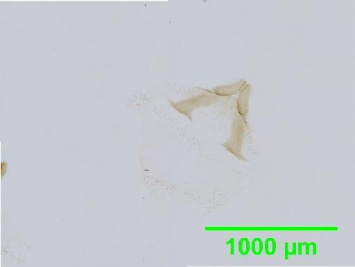 Calopsocus reticuloides Thornton, 1984 - 010138989__2016_03_15-4_s1