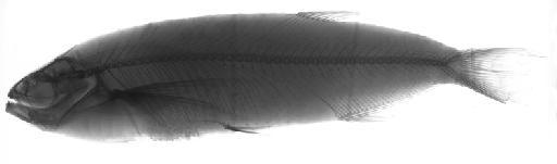 Chalcinus elongatus Günther, 1864 - BMNH 1852.9.13.110, HOLOTYPE, Chalcinus elongatus, radiograph
