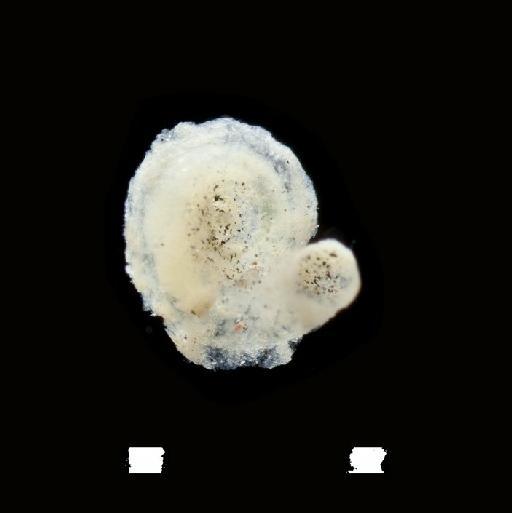 Neodexiospira mannarensis Pillai, 1970 - Polychaeta type specimen; BMNH 1968.162