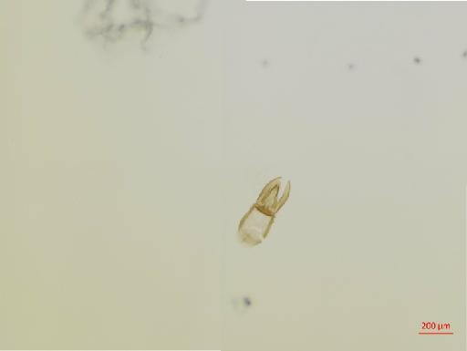 Sturnidoecus distinguendus Ansari, 1968 - 010694496__2017_08_11-Scene-1-ScanRegion0