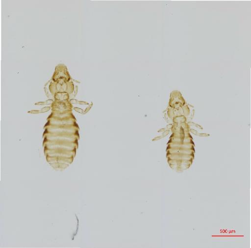 Quadraceps coenocoryphae Timmermann, 1955 - 010686964__2017_08_10-Scene-1-ScanRegion0