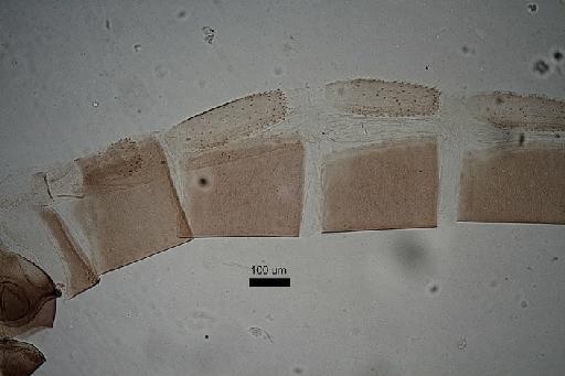 Sergentomyia (Sergentomyia) garnhami Heisch et al., 1956 - Sergentomyia_garnhami-010210162-Abdomen_tergites-10x_1_6