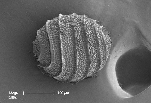 Nitella gelatinifera var. afoliolata (R.D.Wood) C.Agardh - OosporeSide