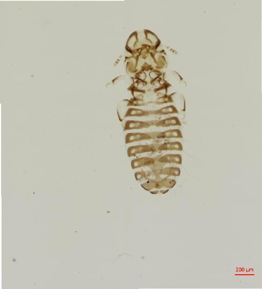 Corvonirmus theresae Ansari, 1957 - 010670901__2017_07_31-Scene-1-ScanRegion0