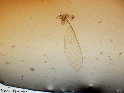 Phlebotomus trinidadensis Newstead, 1922 - Lutzomyia_trinidadensis-BMNH(E)1722000_ST-female_wing-2x.tif