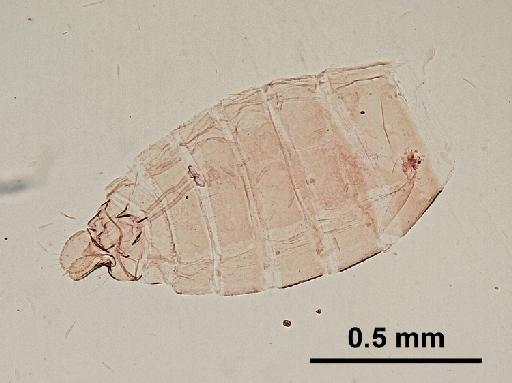 Trichomyia batu Quate, 1962 - Trichomyia_batu-010210260-abdomen-64_0x-scale