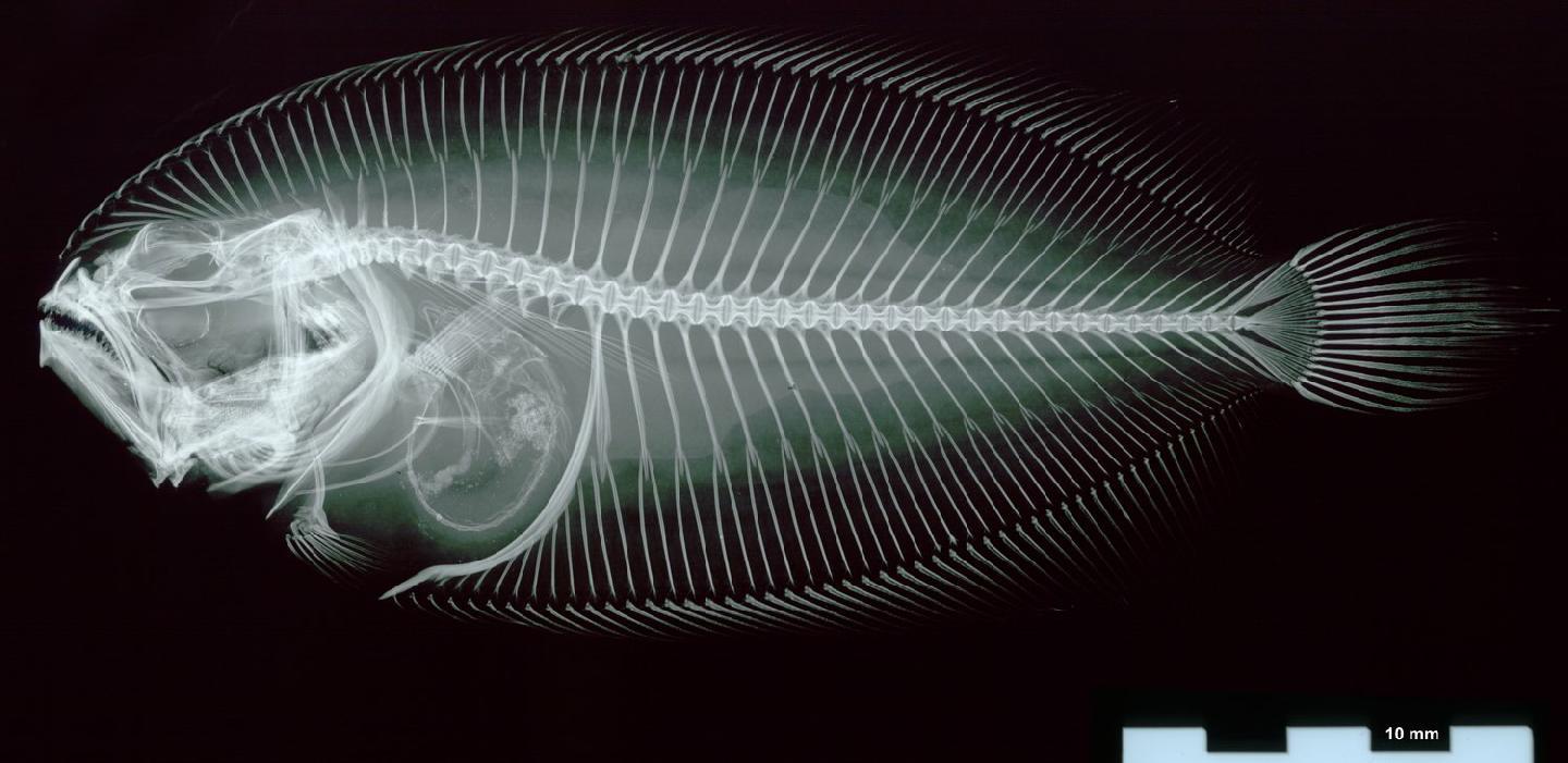 Pseudorhombus spinosus
