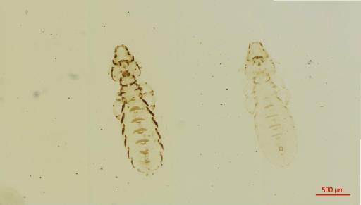 Quadraceps sellatus praestans Kellogg, 1896 - 010688058__2017_08_10-Scene-2-ScanRegion1