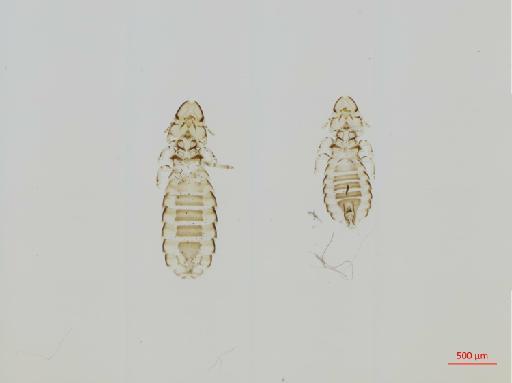 Priceiella (Torosinirmus) nivea Ansari, 1956 - 010670828__2017_07_31-Scene-1-ScanRegion0
