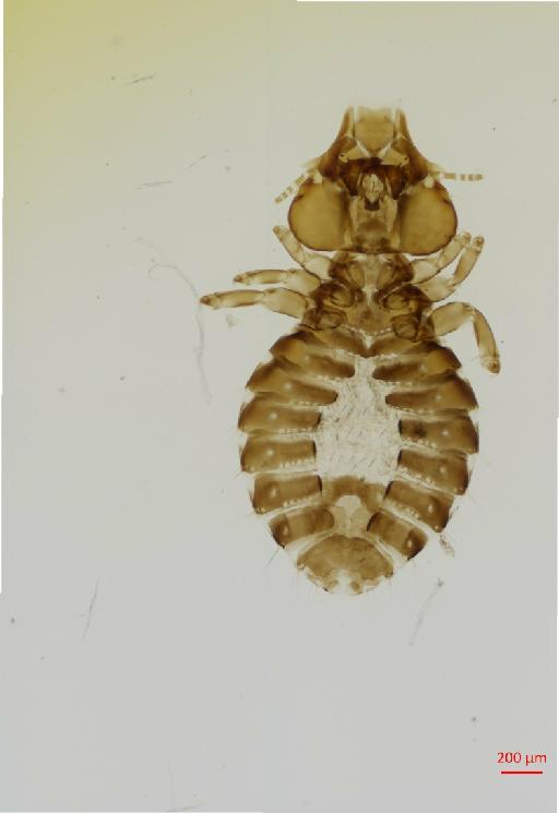 Saemundssonia africana senegalla Timmermann, 1969 - 010690840__2017_08_11-Scene-2-ScanRegion1