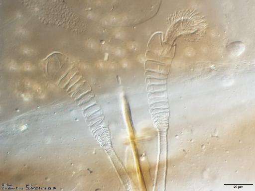 Lutzomyia (Nyssomyia) shawi Fraiha et al., 1981 - Lutzomyia_shawi_BMNH(E)1251317_PT-female_spermathecae-40x.tif