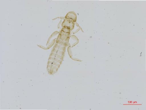 Oxylipeurus formosanus Uchida, 1917 - 010682412__2017_08_09-Scene-1-ScanRegion0