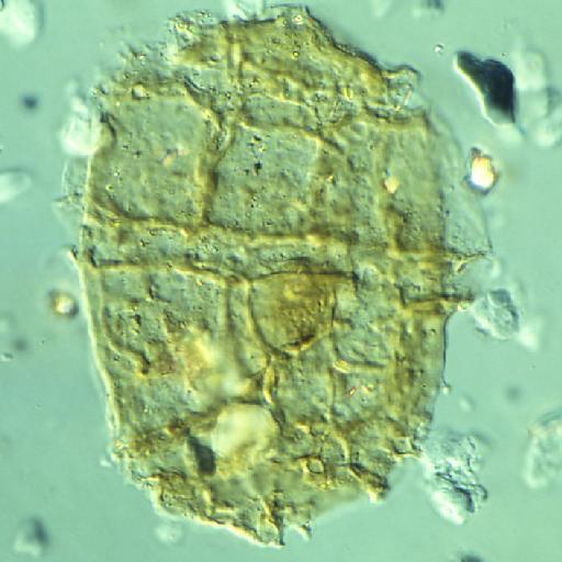 Egmontinium polyplacophorum Gitmez & Sarjeant, 1972 - FD143(1)-3.tif