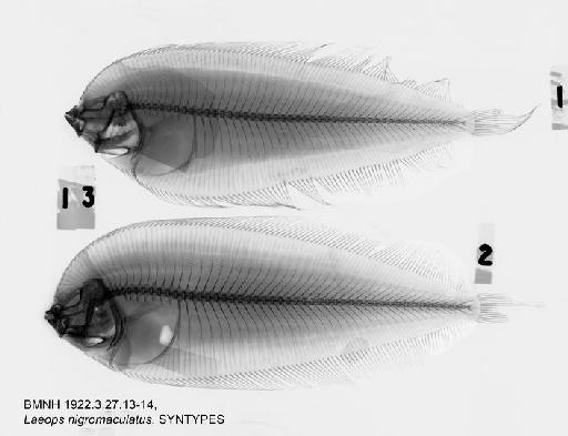 Laeops nigromaculatus von Bonde, 1922 - BMNH 1922.3.27.13-14, SYNTYPES, Laeops nigromaculatus Radiograph