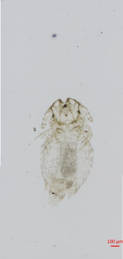 Geomydoecus dakotensis Price & Emerson, 1971 - 010697111__2017_08_16-Scene-1-ScanRegion0