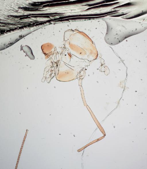 Paratendipes seydeli Freeman, 1957 - 010210312-Paratendipes_seydeli_HOLOTYPE-thorax_B-40_0x