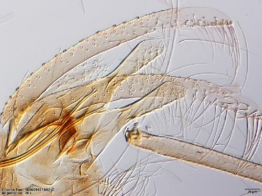 Lutzomyia walkeri species group Migonei Newstead, 1914 - Lutzomyia_walkeri-BMNH(E)1722100_PR-male_paramere-20x.tif