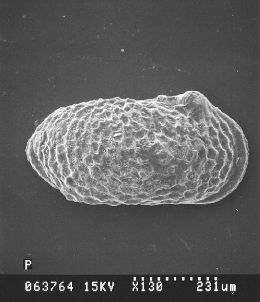 Acanthocythere (Protoacanthocythere) faveolata Bate, 1963 - S2500_063764_Io_561.tif