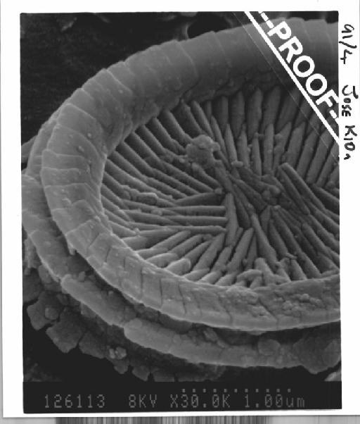 Syracosphaera pulchra - 091-04.jpg