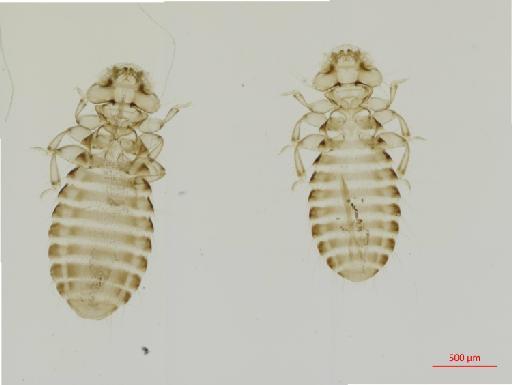 Heteromenopon (Keamenopon) kea Kellogg, 1907 - 010657160__2017_07_21-Scene-1-ScanRegion0